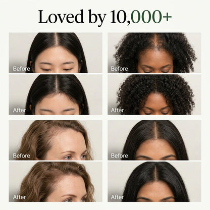 Shampoing Solide Aux Feuilles De Cyprès